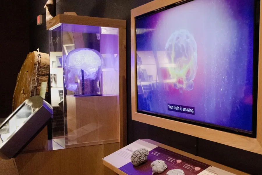 Scan of brain on a screen, with 3D prints of brains in front. 