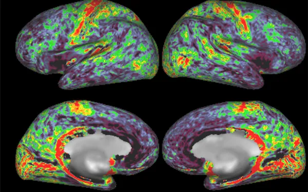Four views of fMRI brain imaging with highlights in green, yellow, and red.